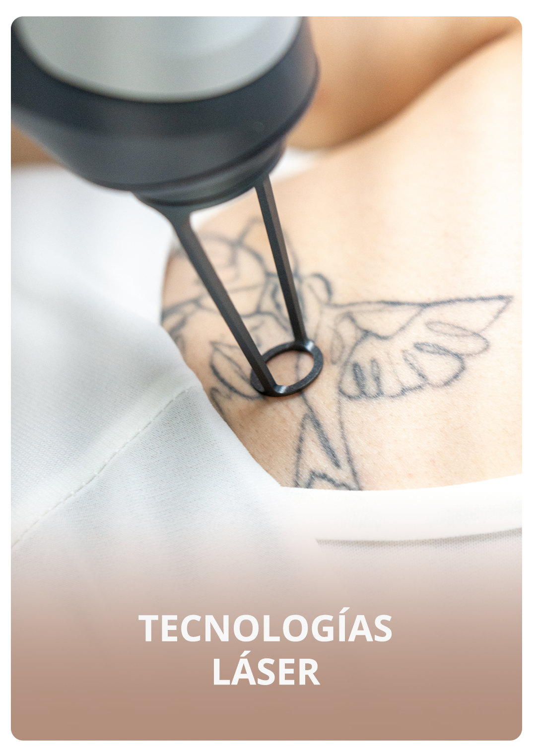tecnologias_laser